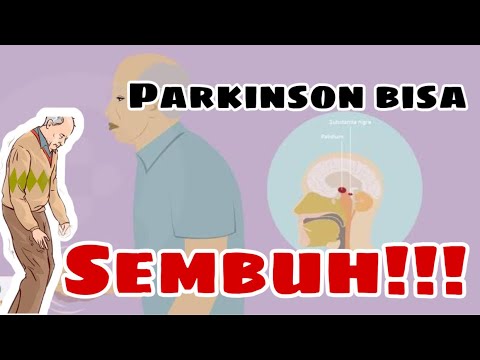 Bagaimana Terapi Penyakit PARKINSON II Apakah Parkinson BISA SEMBUH