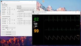 Infirmary Integrated v0.8, Guide Part 3, Cardiac Monitor screenshot 1