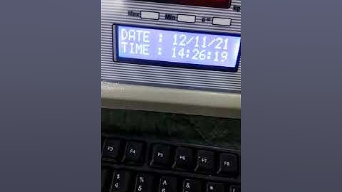 EDITABLE FIELDING OPTION PRINTING SCALE