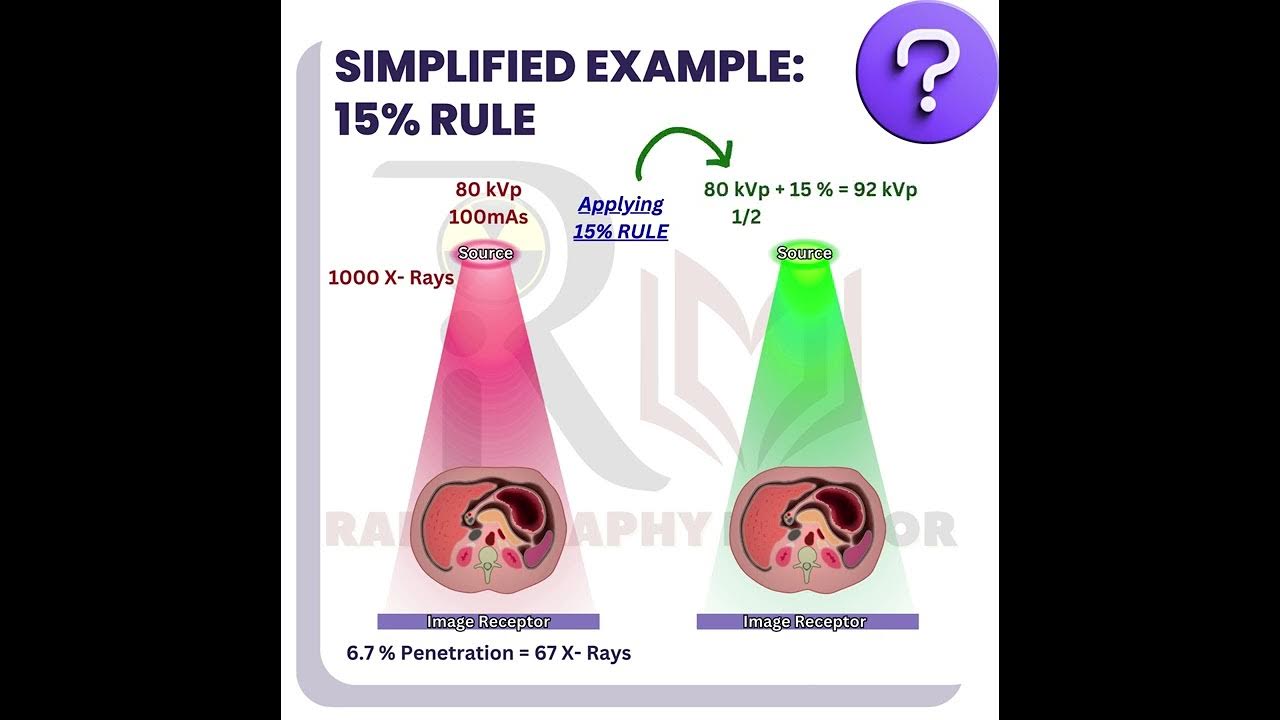 kvp-and-mas-15-5-and-10-kvp-rule-optimizing-patient-radiation