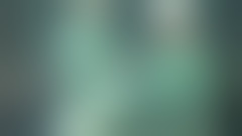 Intramedullary Pinning and External Fixation for an Oblique Femur Fracture