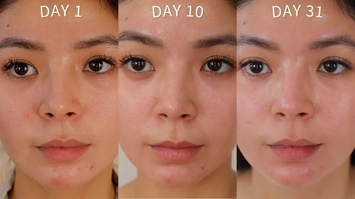 SKINCARE ROUTINE: ZO SKIN HEALTH ONE MONTH RESULTS