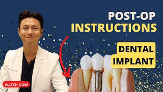 IMPLANT POST OP INSTRUCTIONS | Must Watch After Dental Implant!