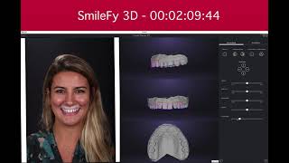 SmileFy's 3D Smile Design Demo (Mac Demo) screenshot 1