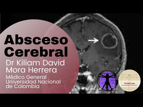 Absceso Cerebral | Dr Kiliam David Mora Herrera
