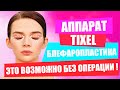 С этим аппаратом ботокс не нужен! Подтяжка и лифтинг сразу