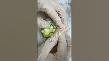 Dirty Velvet Mochi Pimple Popping  #pimplepopping #relax #visualasmr  #cats #mochipimplepopping