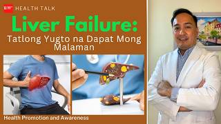 Atay mo alagaan mo: Stages of Liver Failure
