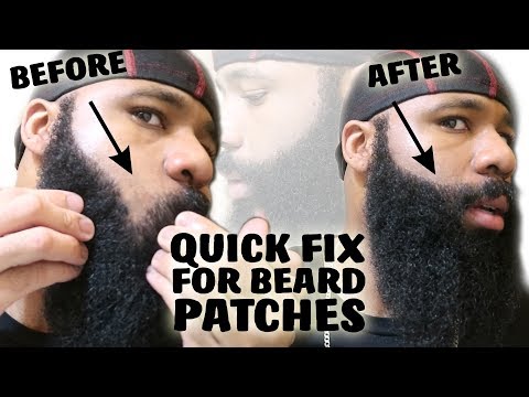 quick-fix-for-a-patchy-beard-|-growing-a-thick-mustache-for-no-shave-november
