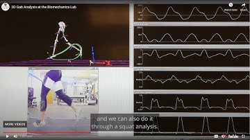 3D Gait Analysis at the Biomechanics Lab