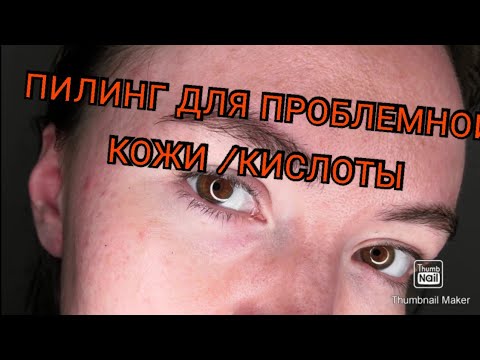 Пилинг для проблемной кожи + севан скин метод👌