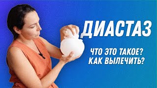 видео: Диастаз что это? Как определить? Как лечить? | Остеопат Марина Просветина картинка: Диастаз что это? Как определить? Как лечить? | Остеопат Марина Просветина