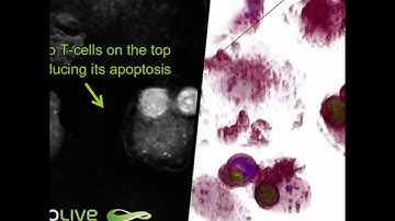 The perfect murder - Macrophage cell killed by T-cells