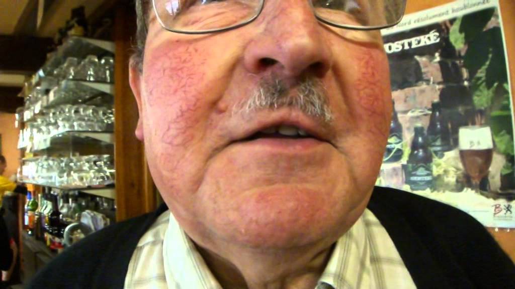 'Anosteké' - Echt vlaams dialect in Noord-Frankrijk