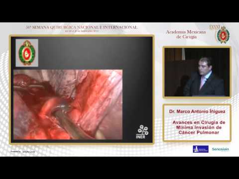 Avances en Cirugía de Mínima Invasión de Cáncer Pulmonar,  Dr. Marco Antonio Íñiguez