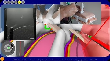 RA Simulation: In-Plane Needling Exercise