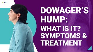 Dowager's Hump - Causes, Symptoms, Treatment - Samarpan