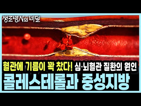 하루 믹스커피 20잔의 결말은 심각한 정도로 높은 중성지방 수치... 혈관의 적, 콜레스테롤과 중성지방 I KBS 20200108 방송