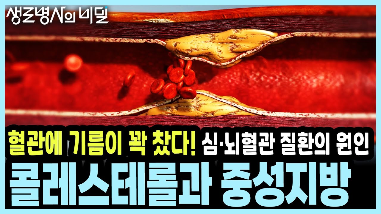 하루 믹스커피 20잔의 결말은 심각한 정도로 높은 중성지방 수치... 혈관의 적, 콜레스테롤과 중성지방 I KBS 20200108 방송