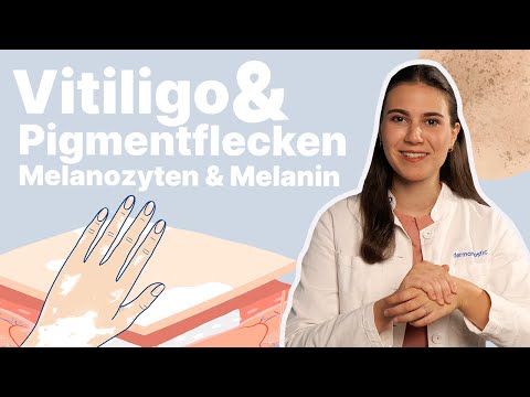 Video: Vitiligo vorbeugen (mit Bildern)