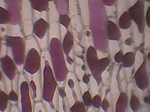 Βίντεο: Τι είναι η πλασμόλυση σε ένα φυτικό κύτταρο;