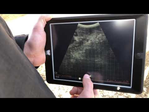 Easi Scan Ultrasound For Sale