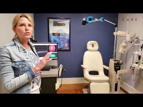 C Eye Care Video 1