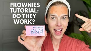 Frownies Facial Patches- Do they work?