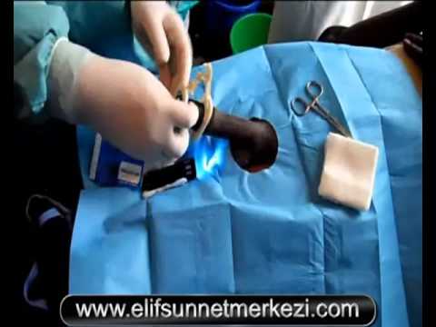 Kenya Circumcision Study from Dr Mustafa Demirelli