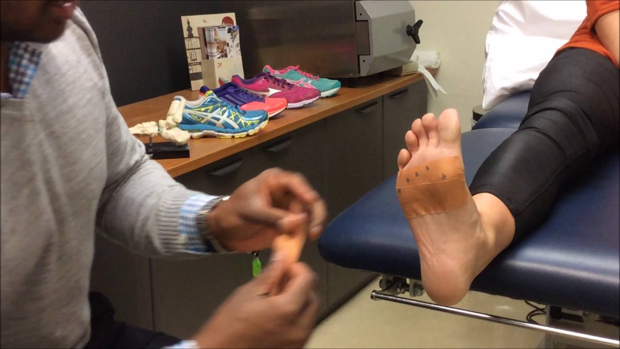 Heel Pain Taping Technique YouTube