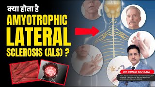 What Is Amyotrophic Lateral Sclerosis  Motor Neuron Disease In Hindi  Dr Kunal Bahrani