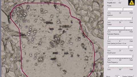 Laser Microdissection with Leica Microsystems