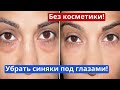 Как убрать синяки под глазами без дорогой косметики дома своими руками!