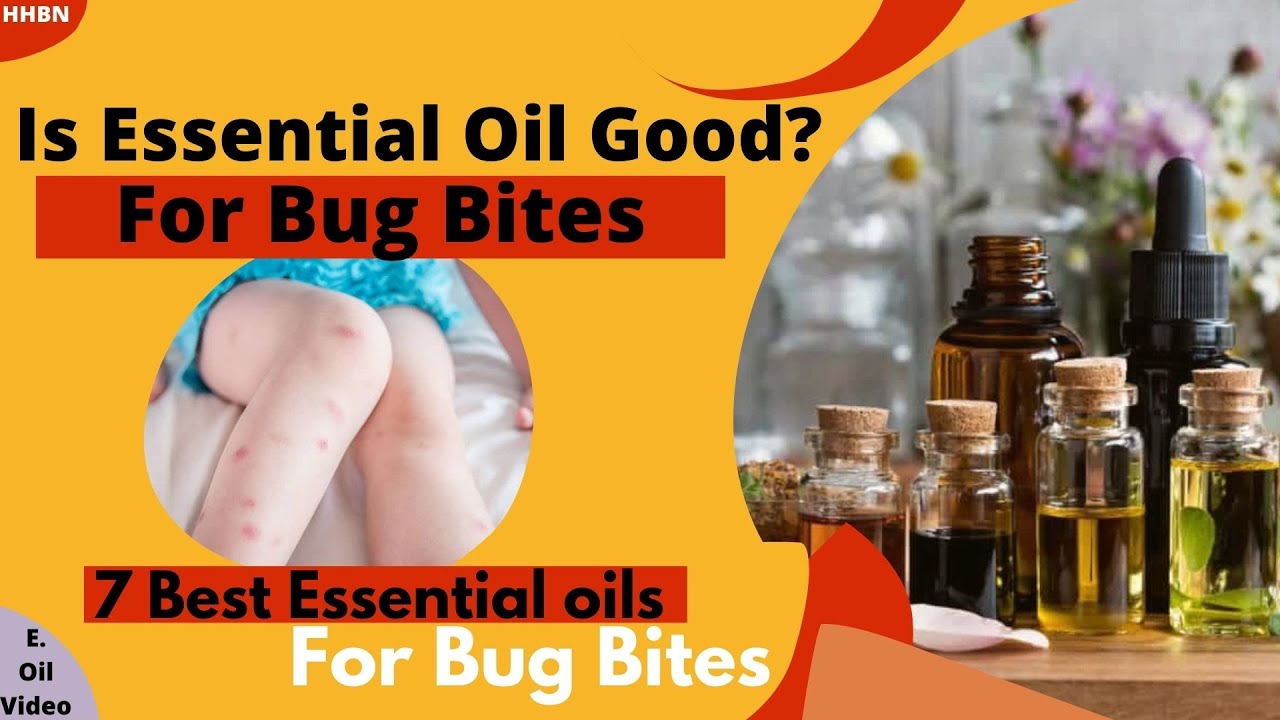 Is Essential Oil Effective for Insect Bite? Essential oil for Bug Bites