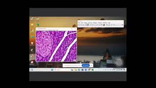Cara Pengukuran Diameter Pulau Langerhans Menggunakan Aplikasi Image J screenshot 3