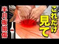 【この動画だけ見てください】実は9割の人は手術する必要がない⁉半月板損傷の見極め方と神ワザ治療法を伝授‼