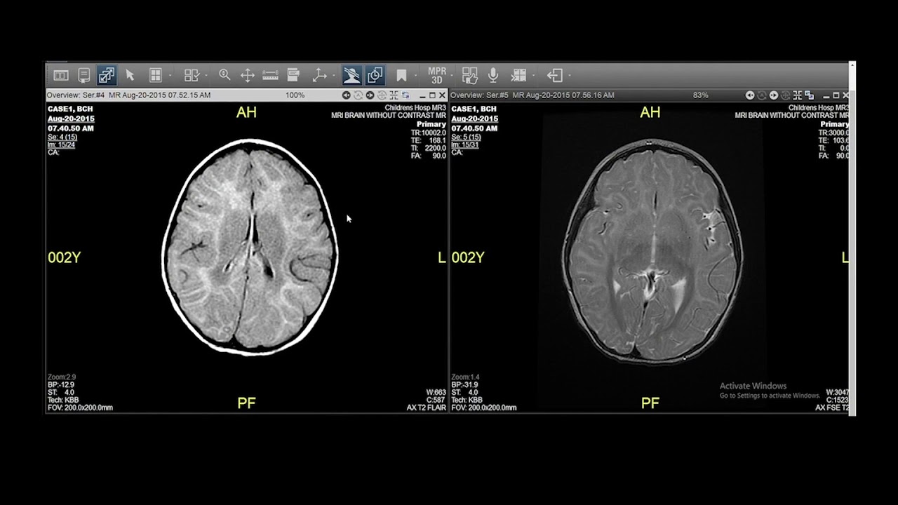 Integrated Reference Study Library for Universal Viewer