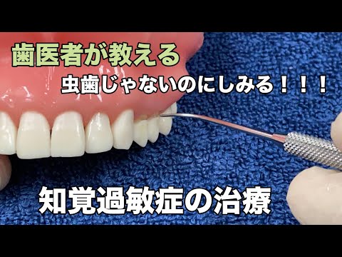 [Yokohama Totsuka Naito Dental] Hypersensitivity