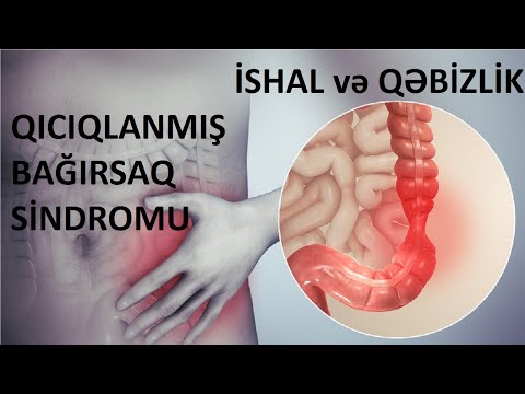 Video: İrritabl Bağırsaq Sindromu (IBS) olan birinə kömək etməyin 3 yolu