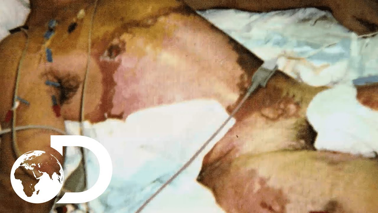 shocking definition Florida Man Gets Struck By Lightning | Raging Planet