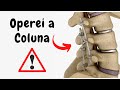Operei a coluna, e agora?