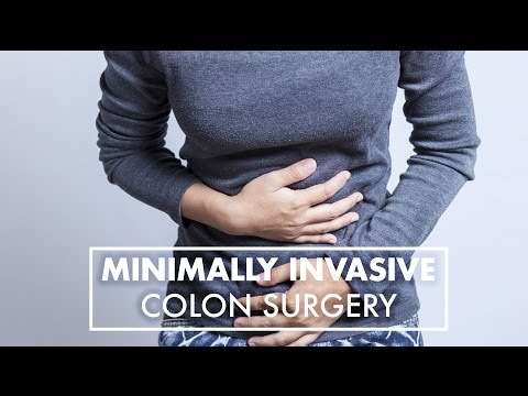 Minimally Invasive Colon