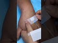 How to Give an Intramuscular Injection Safely | IM Injection Step-by-Step Training Guide Class No. 4