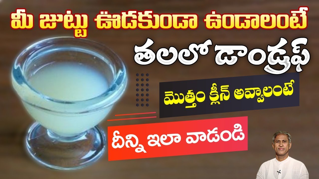 Have you Ever Applied Lemon Juice to your Hair? | Dandruff | Hair Growth | Dr.Manthena's Beauty Tips