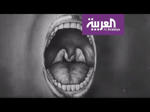 فيديو: هل كانت الدفتيريا فيروساً؟