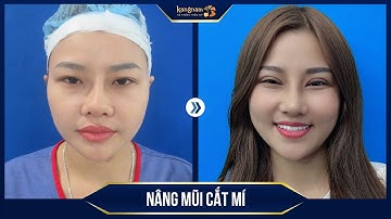 Cái kết khi gửi niềm tin nâng mũi, cắt mí tại Kangnam