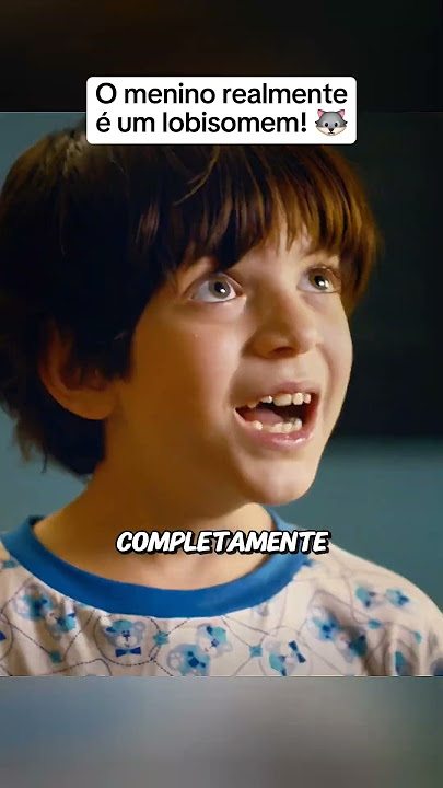 O menino realmente é um lobisomem.