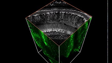 THY 1 neurons in mouse brain