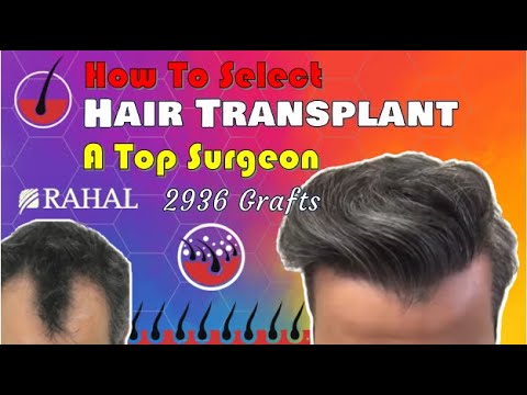 Hair Transplant Result 2936 Fut Grafts Dr Rahal You