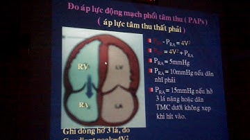 Siêu âm tim - BS Nguyễn Tuấn Vũ (P2)